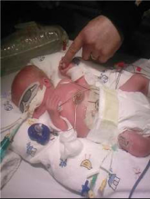 Ethan’s story – Living with PID